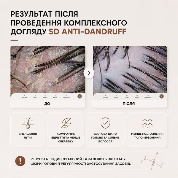 Шампунь для шкіри схильної до лупи SD ANTI-DANDRUFF hair shampoo FF00014-2 фото