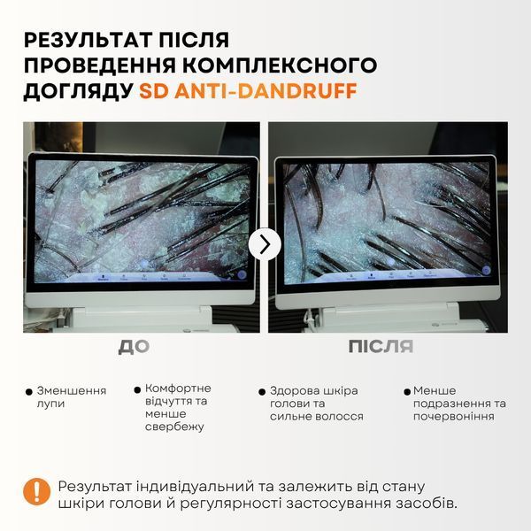 Набір проти лупи для шкіри голови при схильності до себорейного дерматиту SEBODERM FLAKE CONTROL SET FF00334 фото